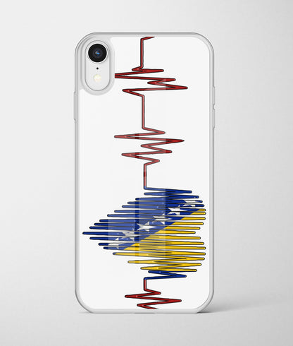 puls | premium staklena maskica – autentična maskica iz moja bosna shop